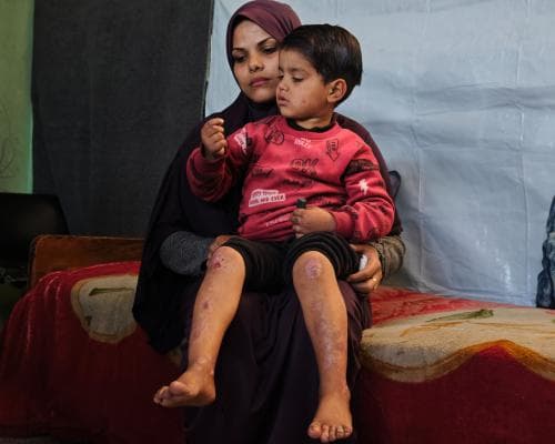 War Leaves Gaza Cancer Patients Trapped