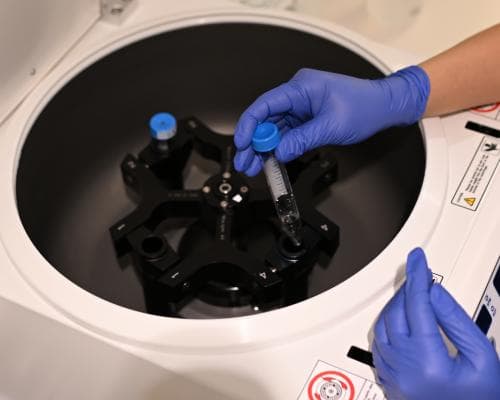 UK IVF Couples Rank Embryos by IQ, Height and Health Scores